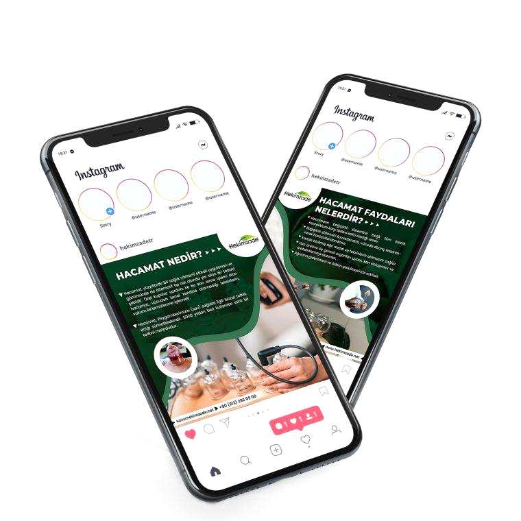 Hacamat Nedir? Faydaları Nelerdir?